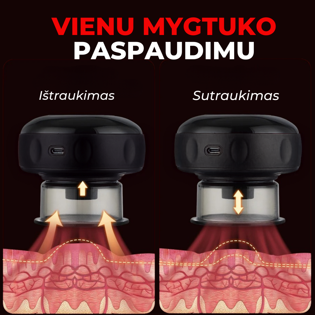 VakPRO® Vakuuminis Kūno Masažuoklis